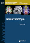 Neurorradiologia