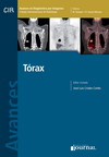 Torax