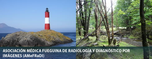 Banner Tierra del Fuego