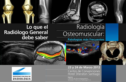 Radiología Osteomuscular