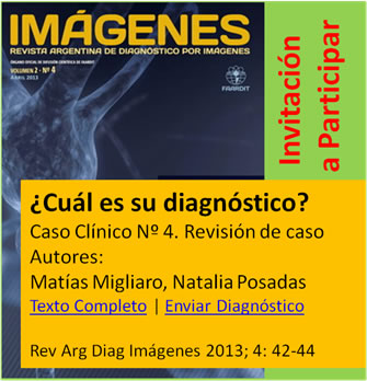 Caso Clínico Nº 4. ¿Cuál es su diagnóstico?