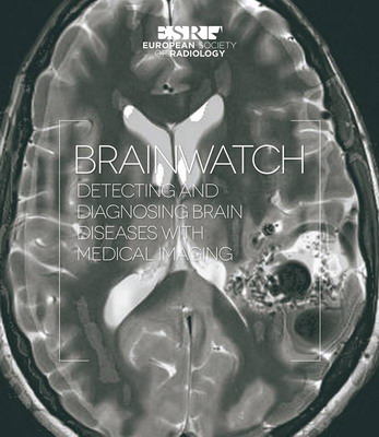 BrainWatch