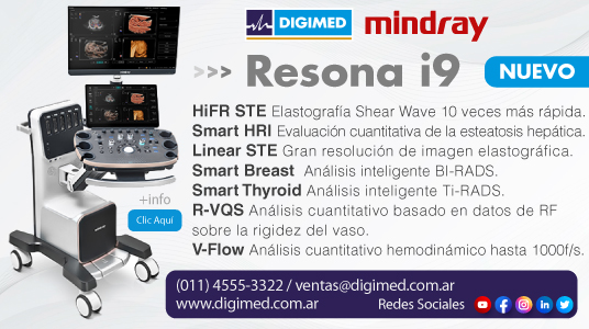 Digimed Mindray Resona i9